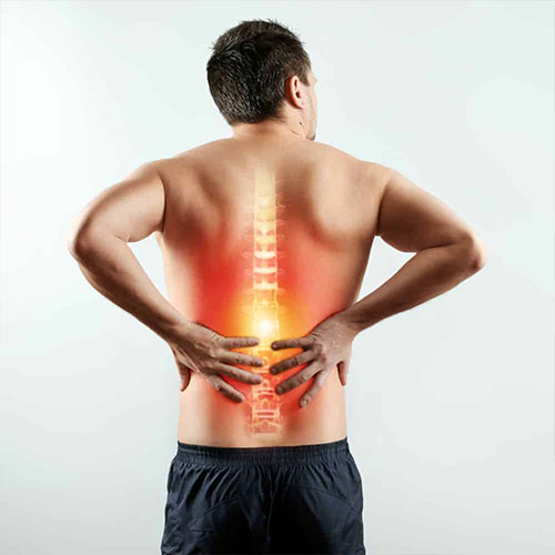 Sciatica Pain
